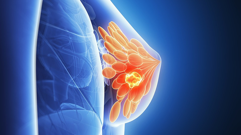 Cancer du sein sous couvert : comment les cellules tumorales hibernent et ripostent Cancer_du_sein_sous_couvert___comment_les_cellules_tumorales_hibernent_et_ripostent