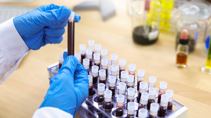 Percée dans la thérapie génique pour l’hémophilie B en Chine continentale Percée dans la thérapie génique pour l'hémophilie B en Chine continentale