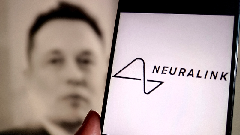 Les implants cérébraux N1 de Neuralink atteignent sept bénéficiaires Les implants cérébraux N1 de Neuralink atteignent sept bénéficiaires