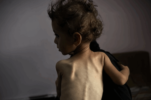 Famine déclaré à Gaza : Une crise humanitaire en cours Famine déclaré à Gaza : Une crise humanitaire en cours