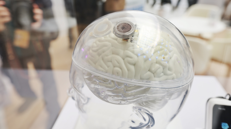 La révolution technologique médicale en Chine ouvre de nouvelles possibilités de vie La révolution technologique médicale en Chine ouvre de nouvelles possibilités de vie