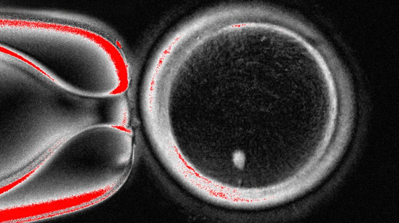 Les scientifiques transforment des cellules de peau en ovules humains dans une percée de laboratoire Les scientifiques transforment des cellules de peau en ovules humains dans une percée de laboratoire